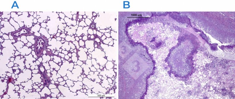 Figure 2. Haematoxylin and eosin stain in a normal (A) and damaged (B) lung. The lung in B is affected by a fibrino-necrotizing pleuropneumoniae caused by Actinobacillus pleuropneumoniae.