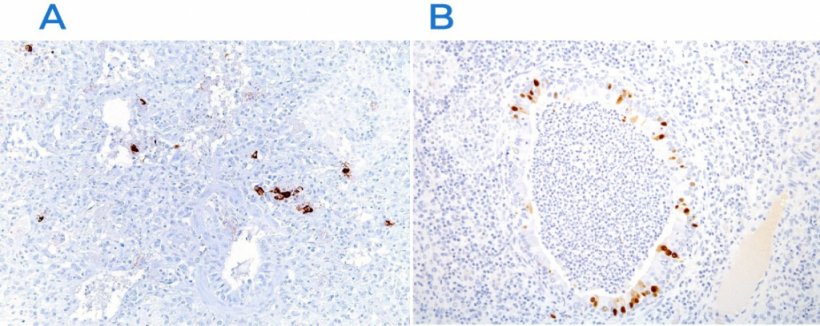 Figure 3. Immunohistochemistry to detect porcine reproductive and respiratory syndrome virus (PRRSV) (A) and swine influenza virus (B). Note that presence of viral antigen (brown staining) is found in damaged areas.
